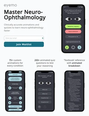 Eyemo App Designed by Sunjay Parmar